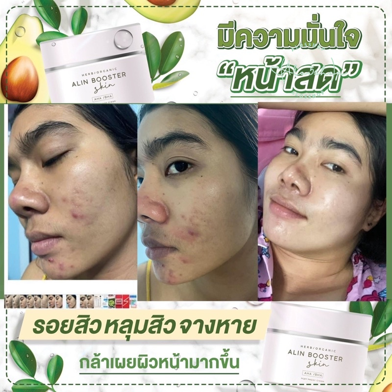 alin-booster-ครีมรักษาสิว-ครีมหน้าขาว-อลินบูสเตอร์-ส่งไว-ครีมหน้าใส-ลดจุดด่างดำ-ฝ้ากระ