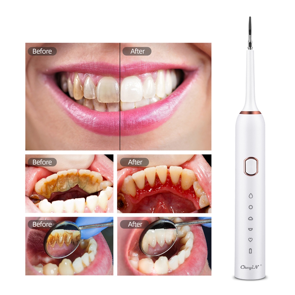 ckeyin-เครื่องกําจัดคราบจุลินทรีย์ไฟฟ้า-แบบชาร์จ-usb-พร้อมหัวทําความสะอาด-5-โหมด-2-หัว