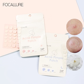 ภาพหน้าปกสินค้าFocallure แผ่นสิว  แผ่นแปะสิว สิว  รักษาสิว บำรุงผิว ซ่อมแซม กันน้ำ ทำความสะอาดอย่างเชี่ยวชาญ ที่เกี่ยวข้อง