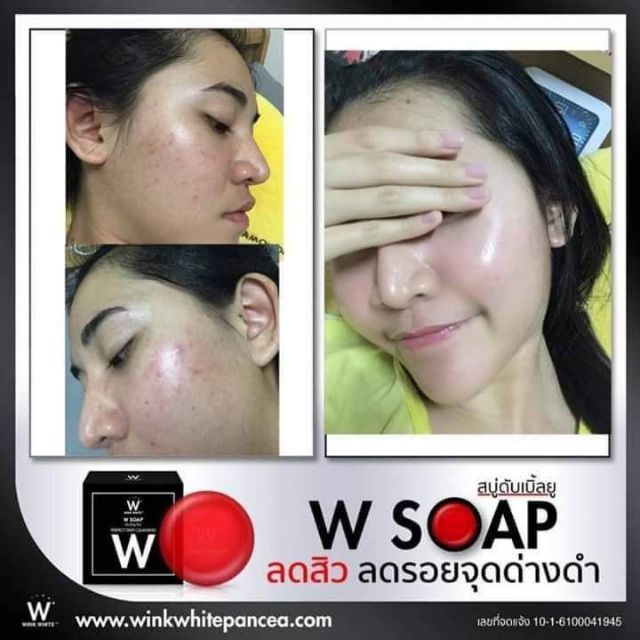 w-soap-สบู่วิงค์ไวท์