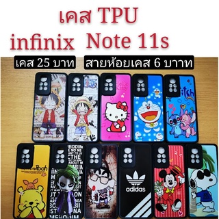 เคส TPU infinix NOTE 11S  เคสกันกระแทก Note11S ลายการ์ตูน น่ารัก เคสโทรศัพท์มือถือ infinix note11S