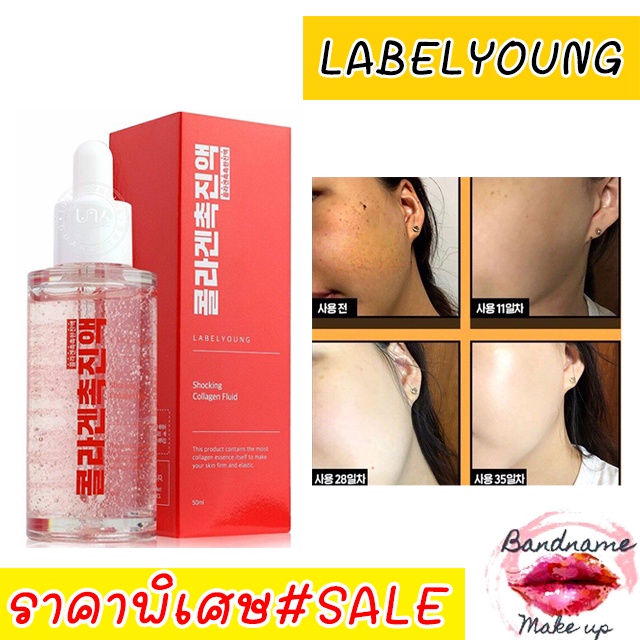 กู้หน้าคล้ำ label young Shocking Collagen Fluid 50ml. | Shopee Thailand