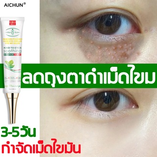 Aichun กำจัดเม็ดไขมัน อายครีม เซรั่มรอบดวงตา 30ml ขจัดฟื้นฟูผิวตา เพิ่มความชุ่มชื่น กำจัดถุงใต้ตา เม็ดไขมัน ครีมบำรุงรอบ