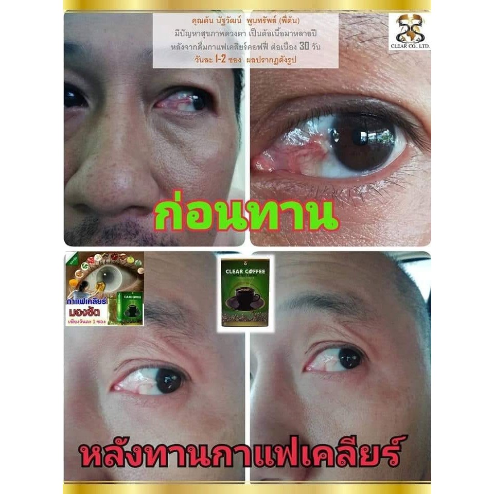 clear-coffee-plus-เคลียร์-คอฟฟี่-พลัส-กาแฟบำรุงสายตา-ปรับสมดุลร่างกาย-บล็อค-และ-เบิรน์-ไขมันส่วนเกิน-ช่วยให้สุขภาพดี