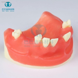 ❡✳ทันตกรรมช่องปากรุ่นสีแดง maxillary implant รุ่นสามารถฝึกแผลและเย็บ gingival retraction การสอนรุ่นซิลิโคนอ่อน