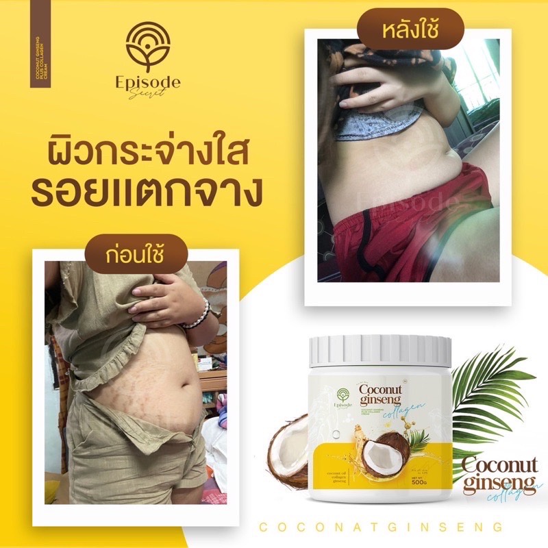 แพคเกจใหม่-ครีมโสมมะพร้าว-สบู่โสมมะพร้าว-สครับโสมมะพร้าว-by-eps