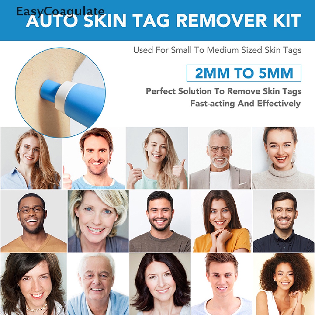 eas-painless-auto-skin-tag-removal-kit-skin-tag-bands-remover-device-new-ate