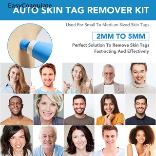 Eas  Painless Auto SKIN TAG Removal kit Skin tag bands Remover Device New Ate