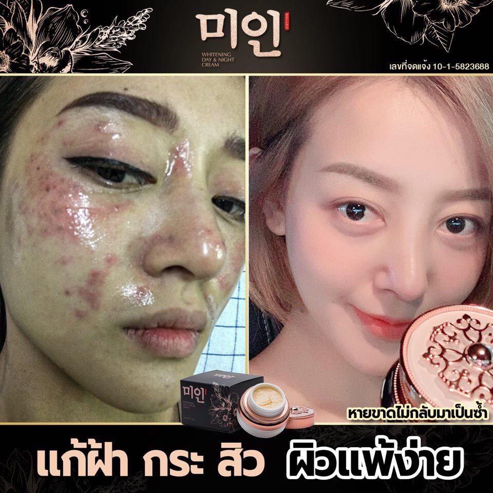 ครีมไข่มุกเกาหลี-หน้าขาวใส-ไร้ฝ้า-กระ-และจุดด่างดำ-เห็นผลไว