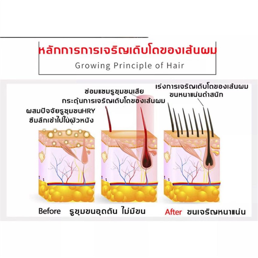 น้ำยาปลูกหนวด-เร่งหนวดยาว-ปลูกเครา-ปลูกคิ้ว-ยาปลูกหนวด-ยาปลูกเครา-น้ำยาปลูกคิ้ว-น้ำยาปลูกหนวด-น้ำยาปลูกเครา-ด้วย-30ml