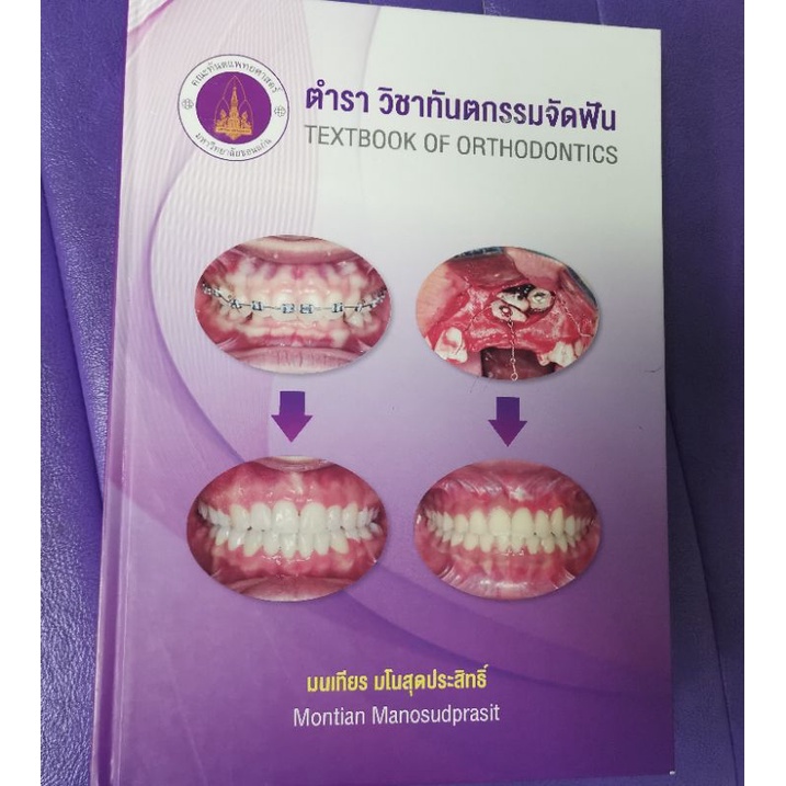 ตำราวิชาทันตกรรม-จัดฟัน-orthodontic-textbook