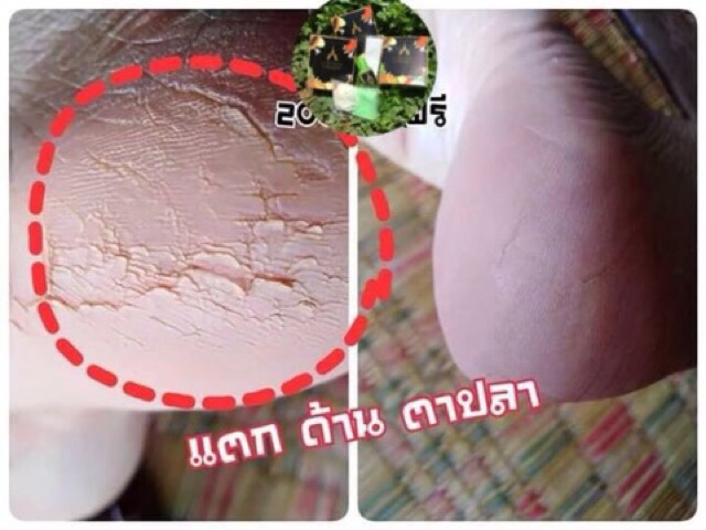 ของแท้-ของแท้-พร้อมส่ง-สปาเท้านางงามใช้ดี