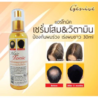 Genive Hair Tonic ลดผมร่วง ปลูกผม 120มล