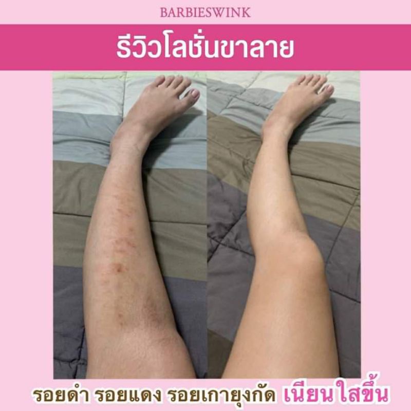 โลชั่นขาลาย-barbieswink-ของแท้พร้อมส่ง