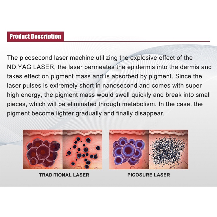 best-effective-skin-whitening-755nm-hnoeycomb-picosecond-laser-532nm-1064nm-1320nm-q-switch-nd-yag-laser-tattoo-removal