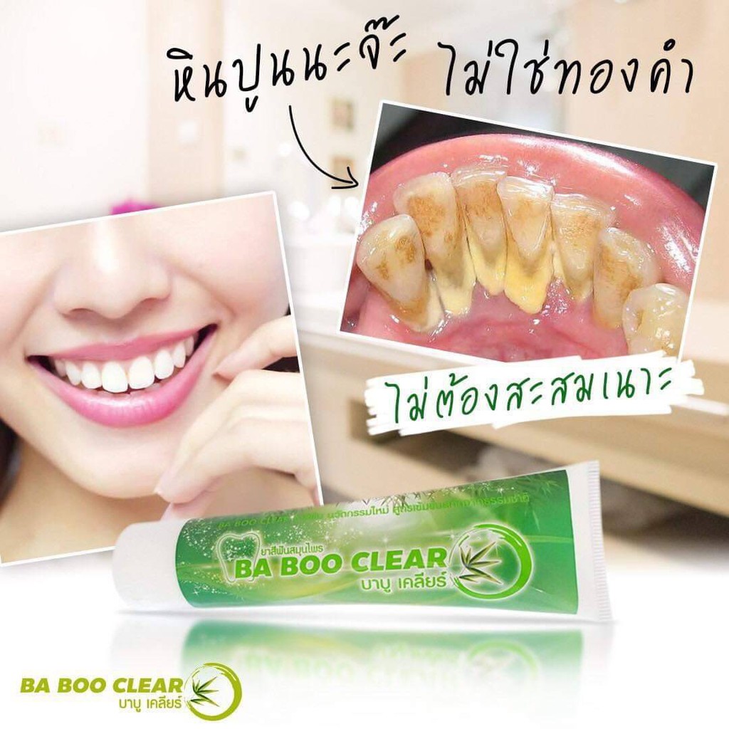 หินปูน-กลิ่นปาก-เหงืออักเสบ-ฟัน-เหลือง-ตื่นเช้ามาจากกลิ่นปากแรงๆ-babooclear-เคลียร์ให้