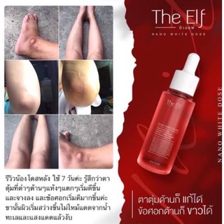 The Elf Nano White Dose ดิเอลฟ์ นาโนไวท์โดส หัวเชื้อโดสตัวขาว ขนาด 60 มิลลิลิตรแท้ ⚡พร้อมส่ง⚡