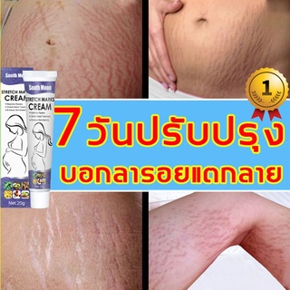 ช้อป ครีมทาท้องลาย ราคาสุดคุ้ม ได้ง่าย ๆ | Shopee Thailand