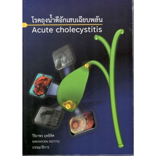 c111 โรคถุงน้ำดีอักเสบเฉียบพลัน (ACUTE CHOLECYSTITIS) 9786165885508