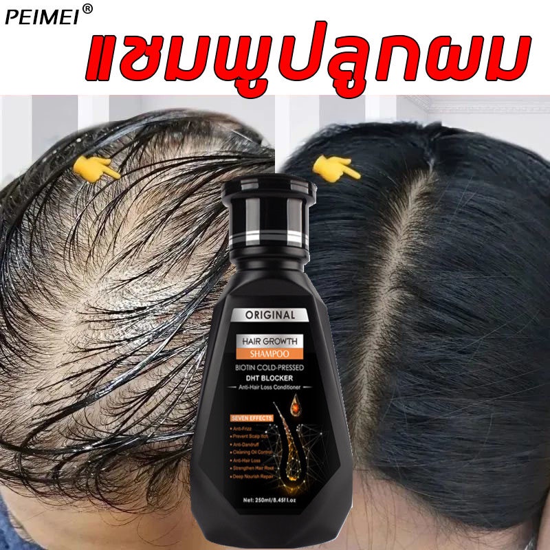 peimei-แชมพูสมุนไพรขิงบำรุงผม-250ml-แชมพูปลูกผม-แชมพูปลูกผมดก-ยาสระผมเร่งผมยาว-แชมพูขิง-แชมพูสมุนไพร-แชมพูบำรุงผม