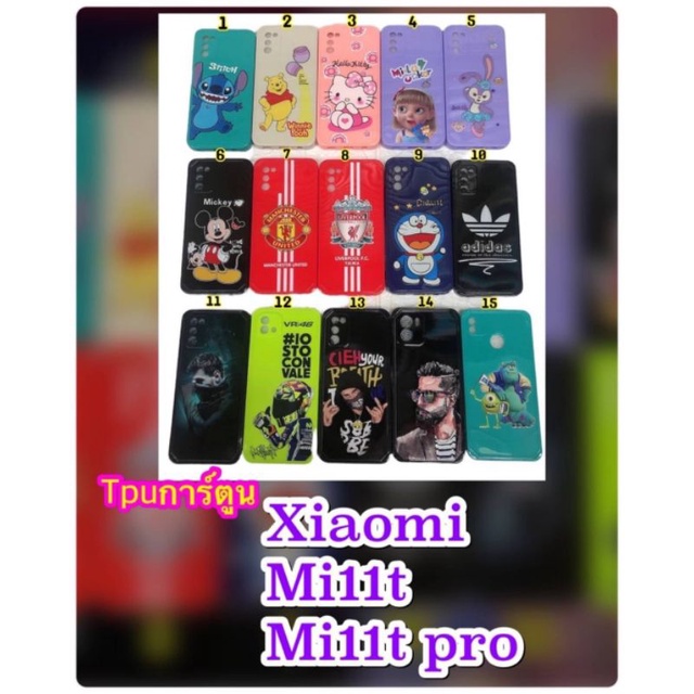 พ้อมส่งเคสtpu-การ์ตูน-wiko-sunny5-wiko-u20-u10-tacno-pop4-tacno-pop-5-พ้อมส่งถึงบ้านคุณ