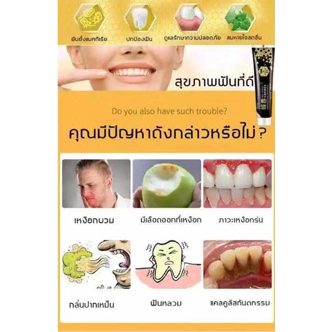 ยาสีฟันพิษผึ้งbeevenom-ยาสีฟันฟอกฟันขาว-ขจัดหินปูน-คราบเหลือง-กำจัดกลิ่นปาก-ลดอาการเสียวฟัน-ยาสีฟันสมุนไพรแก้ปากเหม็น