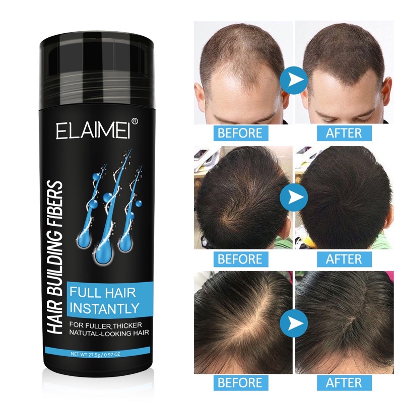 elaimei-hair-building-fiber-เส้นใยธรรมชาติ-ที่จะช่วยให้ผมที่ดูบางหนาขึ้นอย่างเป็นธรรมชาติ-ไม่เหนียวเหนอะหนะติดทนทั้งวัน