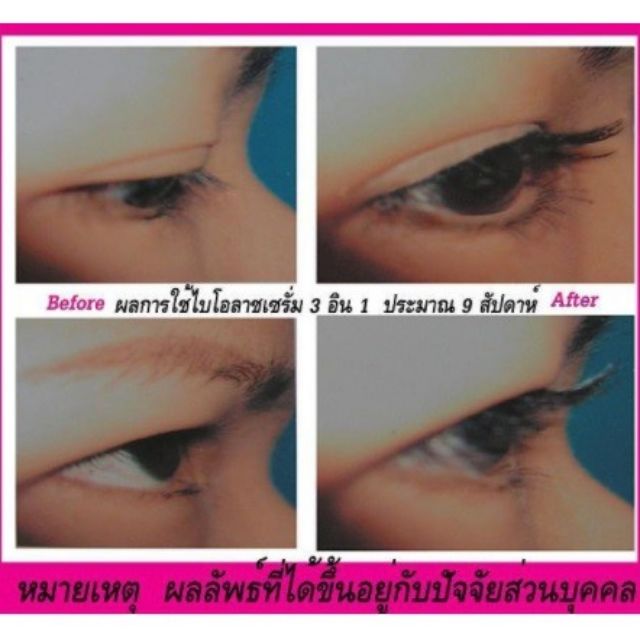 bio-lashes-ไบโอแลช-ปลูกขนตา-สมุนไพรบำรุงขนตา-ขนคิ้ว-บำรุงไรผม