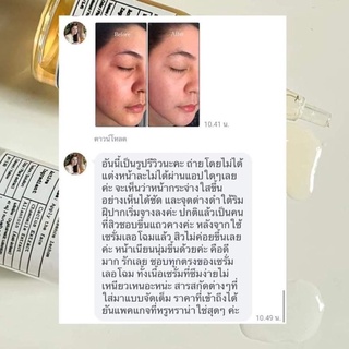 ภาพขนาดย่อของภาพหน้าปกสินค้าแท้100% เซรั่มเลอโฉม 1 แถม 1 Lechom Serum เลอโฉม ลดสิว รอยสิว ผิวเเพ้ง่ายใช้ได้ จากร้าน mychicha บน Shopee ภาพที่ 6