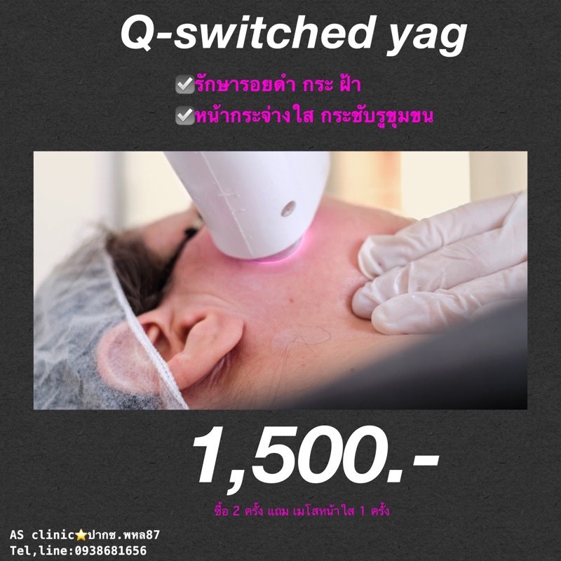 ภาพหน้าปกสินค้าQ-switched ลบฝ้ากระ รอยดำ ปาน หน้าใส จากร้าน jaxsronan บน Shopee