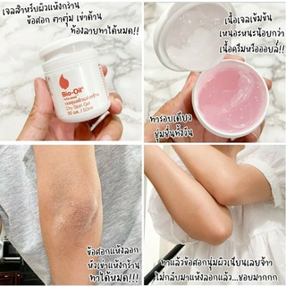 Bio-Oil เนื้อเจล ไอเทมสำหรับคนผิวแห้ง ช่วยเพิ่มความชุ่มชื้นให้ผิว ทากันท้องแตก ทาผิวแตกลาย ข้อศอก ตาตุ่มได้หมดขนาด50ml