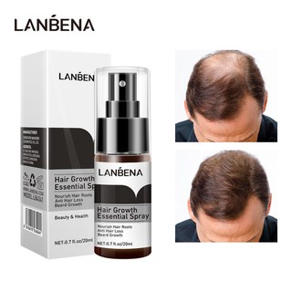 LANBENA สเปรย์ปลูกผม บำรุงเส้นผมและหนังศีรษะ การควบคุมความมัน ป้องกันรังแค Hair Growth Essence Spray 20ml.