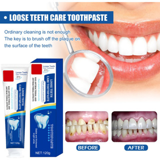 ยาสีฟันรักษาเหงือก ราคาพิเศษ | ซื้อออนไลน์ที่ Shopee ส่งฟรี*ทั่วไทย!