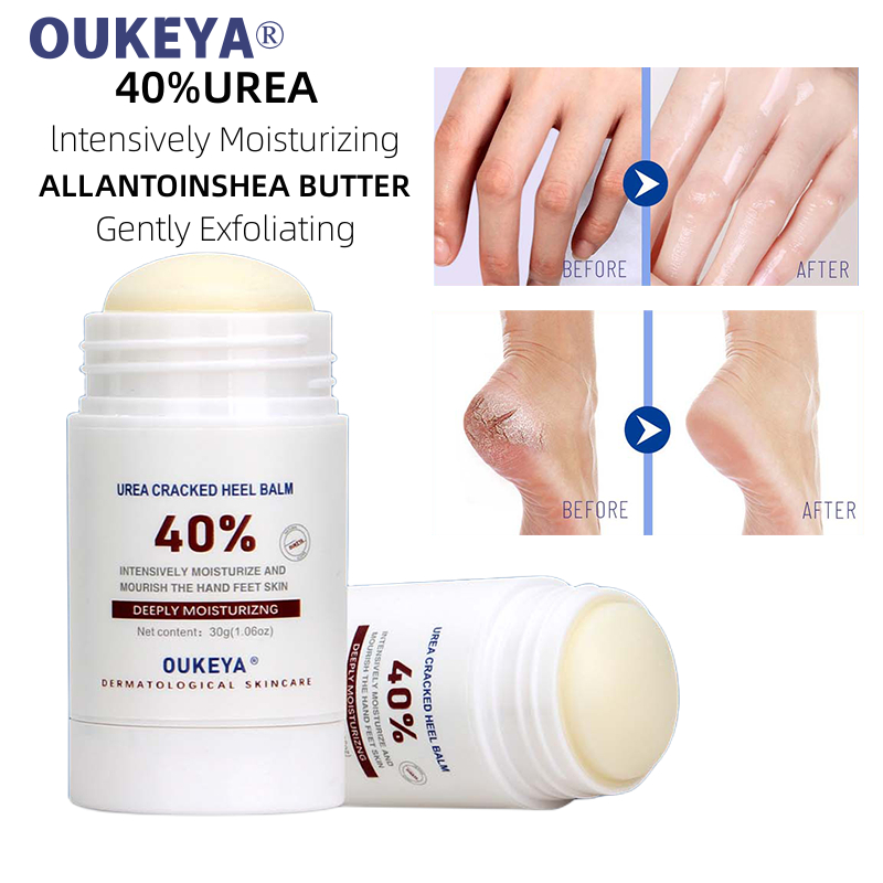 OUKEYA 40 UREA CRACKED HEEL BALM ครีมทาส้นเท้าแตก ผลิตภัณฑ์ดูแลมือและ