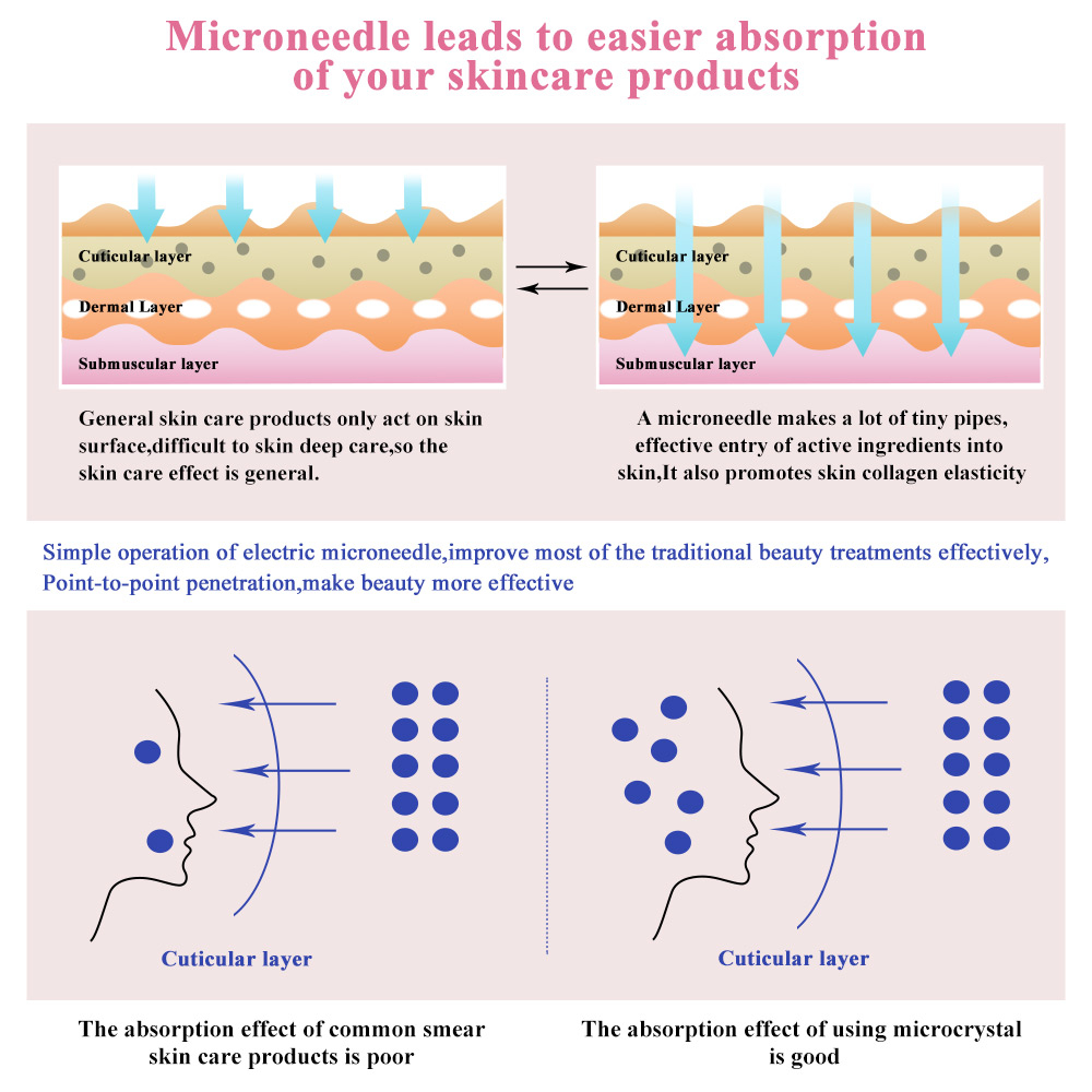 dr-pen-ultima-e30-ปากกาแสตมป์ไฟฟ้า-แบบใช้สาย-microneedling-derma