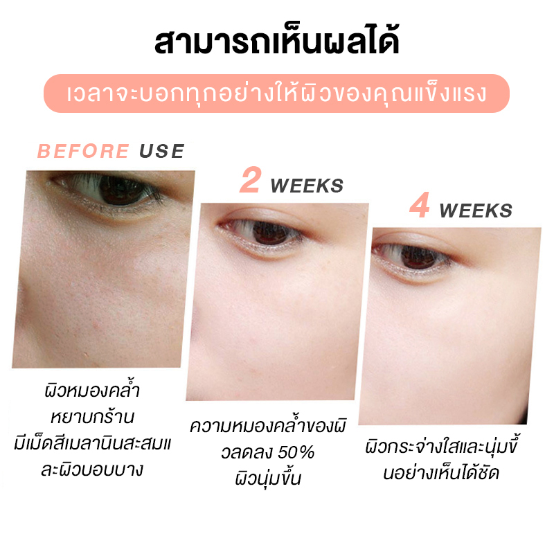 dorothy-arbutin-serum-37ml-เซรั่มหน้าใส-ไวท์เทนนิ่ง-ลดจุดด่างดํา-เซรั่มผิวขาว-สกินแคร์เกาหลี-เซรั่มช่วยให้ผิวกระจ่างใส