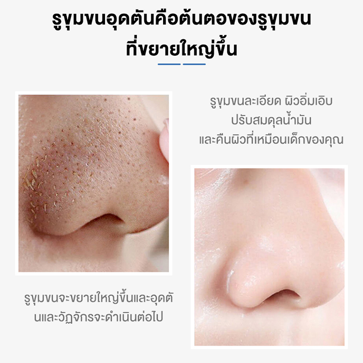 dorothy-lactobionic-acid-pore-refining-serum-37ml-เซรั่มกระชับรูขุมขน-เซรั่มลดสิวอุดตัน-เซรั่มแก้ปัญหาหลุมสิว-ผิวกระชับ-รูขุมขนตื้นขึ้น