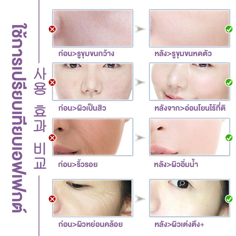 dorothy-pro-xylane-active-emulsion-80ml-ครีมทาหน้า-ครีมเกาหลี-ลดริ้วรอย-สำหรับผิวมัน-เพื่อผิวแลดูอ่อนกว่าวัย