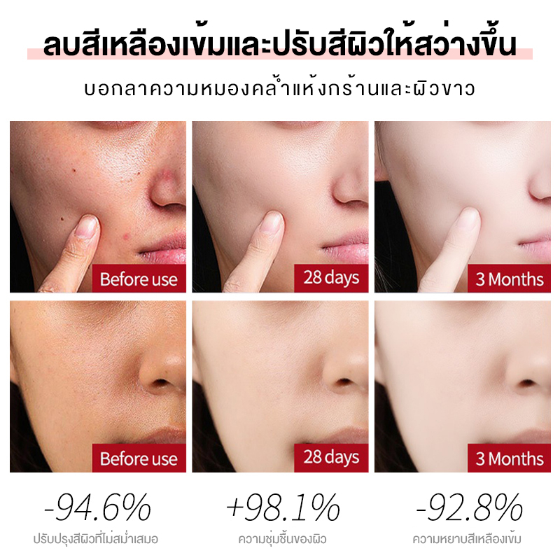 dorothy-arbutin-mask-30ml-5pcs-1box-korea-มาร์คหน้า-มาร์คปรับผิวให้กระจ่างใส-หน้าขาวกระจ่างใส-ผิวเนียนนุ่ม-ชุ่มชื้น