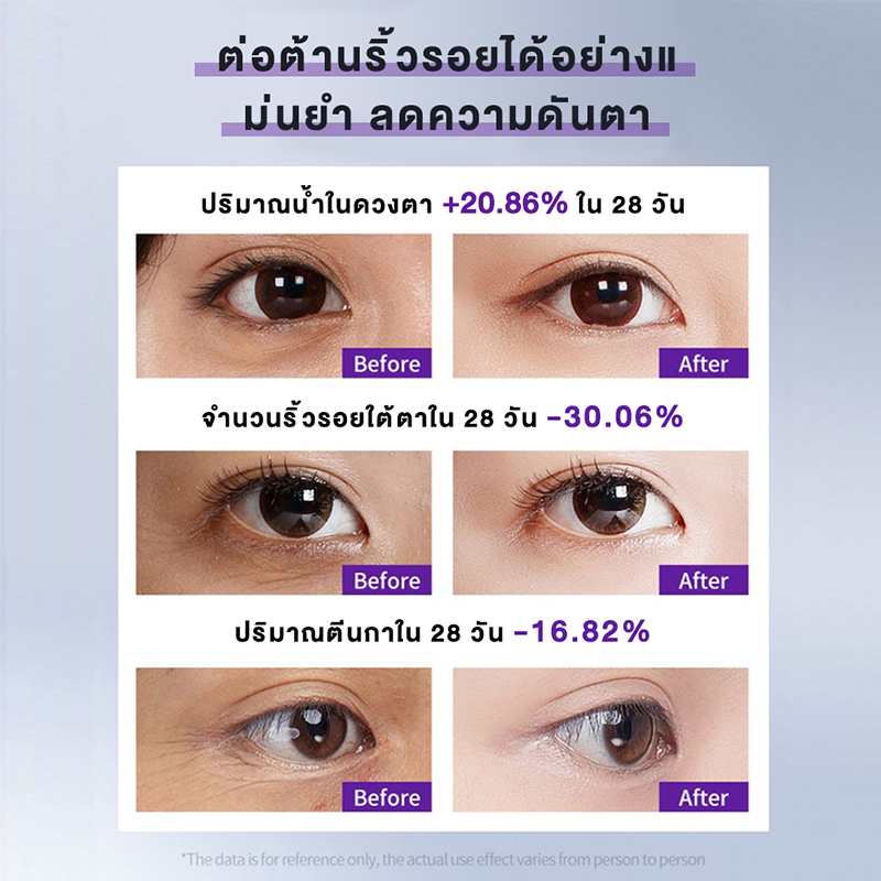 pro-xylane-eye-cream-20g-eye-serum-30ml-จัดการปัญหาริ้วรอย-ความหมองคล้ำ-ครีมบำรุงรอบดวงตา-บรรเทารอยหมองคล้ำและอาการบวม