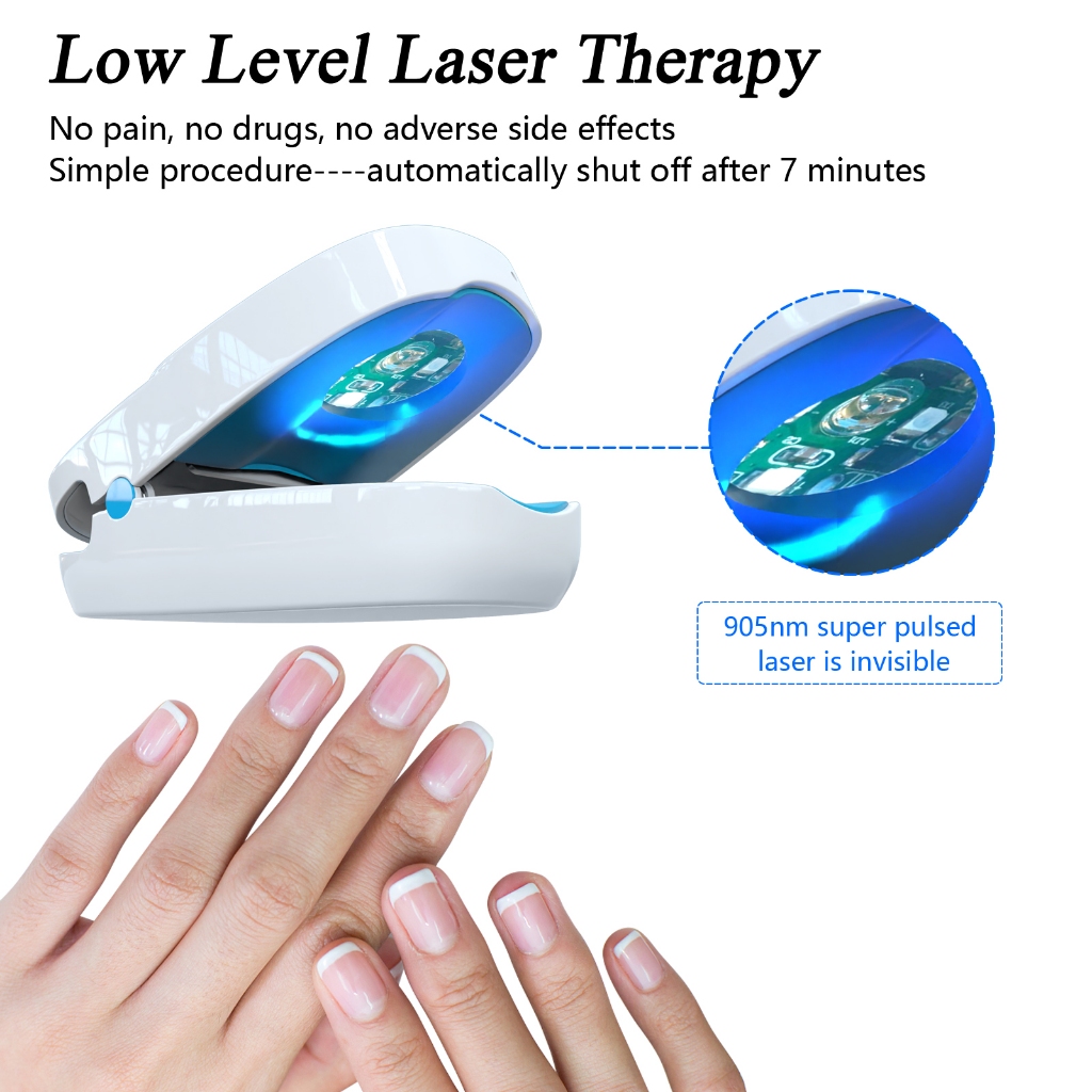 KTS Nail Fungus Laser Therapy Device 905nm 470nm Fungal Nail Treatment for Fingernails Toenails