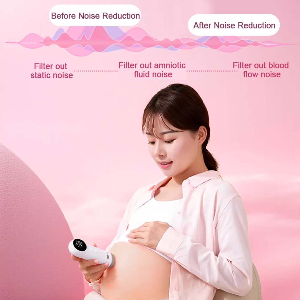 cofoe-fetal-doppler-baby-prenatal-heart-rate-monitor-heartbeat-detector-no-radiation-bluetooth-transmission