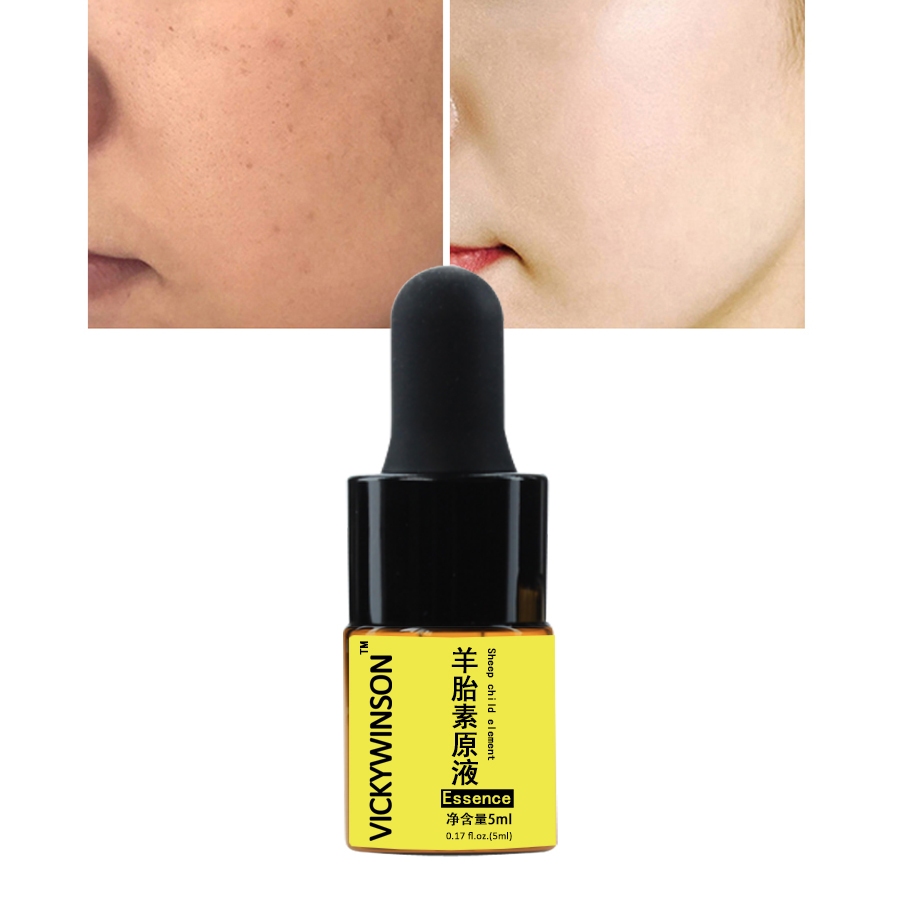 Sheep child Elements Essence 5ml Sheep Placenta Protein Essence Lasting ...