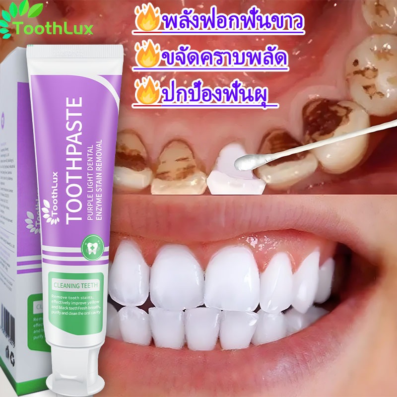 ยาสีฟันคอลเกต อ๊อพติค ไวท์ เพอร์เพิล ลมหายใจหอมสดชื่น ลดกลิ่นปาก 100g