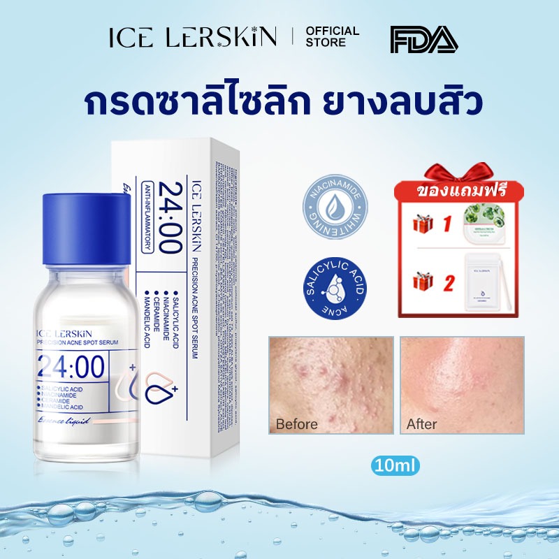 【ซื้อ 1 แถม 1】ICELERSKIN acne Serum Anti acne Lotion 10ml (ลดรอยแดง ลด ...