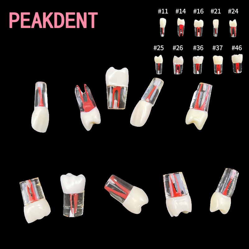 1 ชิ้นทันตกรรม Endo ฟันรุ่น Root Canal Block การฝึกอบรม Endodontic RCT ...
