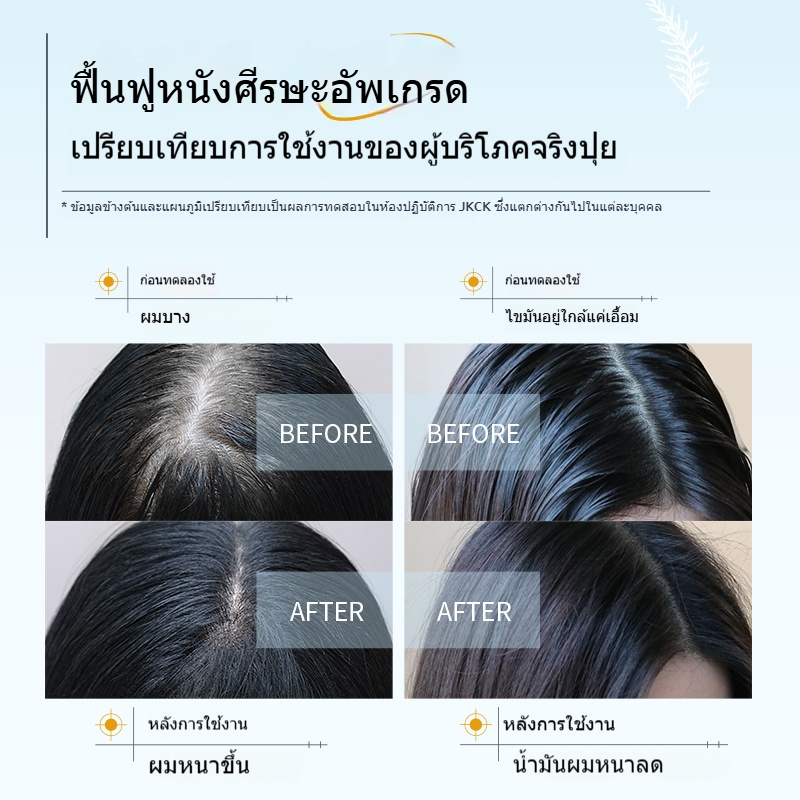 JKCK แชมพู แชมพูควบคุมความมันขจัดรังแค jkck | Shopee Thailand