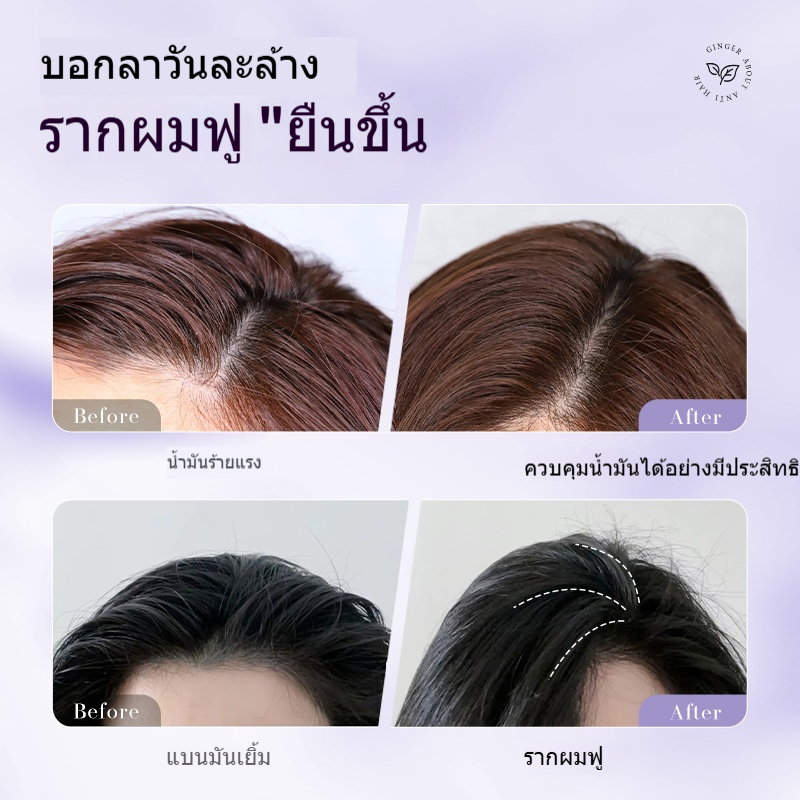 DIGU แชมพู Anti-Stripping และ Oil Control | Shopee Thailand