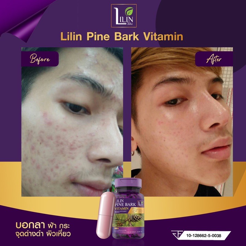 ภาพสินค้าLILIN Pine Bark Vitamin ผลิตภัณฑ์เสริมอาหาร ลิลิน ไพน์บาร์ค วิตามิน วิตามินผิว ลดฝ้ากระ ผิวหมองคล้ำ จากร้าน beautyclub14 บน Shopee ภาพที่ 2