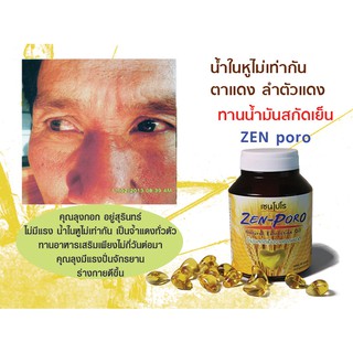 ภาพขนาดย่อของภาพหน้าปกสินค้าZEN  PORO เซนโปโร น้ำมันสกัดเย็น 60 แคปซูล จากร้าน sanookhealthy168 บน Shopee ภาพที่ 3